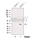 Western blot analysis of extracts from PANC-1 CELLS, using FBXO27 Antibody. The lane on the left was treated with blocking peptide.