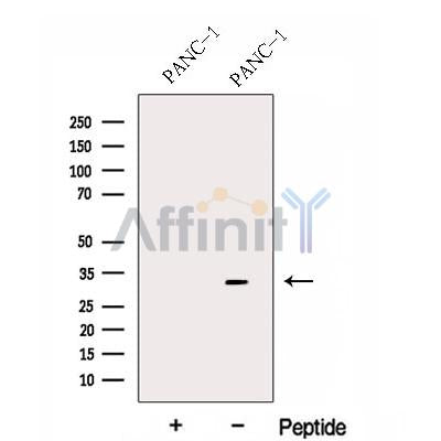 Western blot analysis of extracts from PANC-1 CELLS, using FBXO27 Antibody. The lane on the left was treated with blocking peptide.