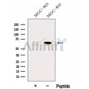 Western blot analysis of extracts from MGC-803 cells, using FBXW11 Antibody. The lane on the left was treated with blocking peptide.