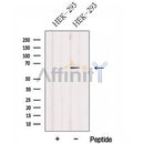 Western blot analysis of extracts from HEK-293 cells, using FBXW5 Antibody. The lane on the left was treated with blocking peptide.