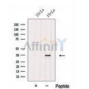 Western blot analysis of extracts from HeLa cells, using FGL1 Antibody. The lane on the left was treated with blocking peptide.