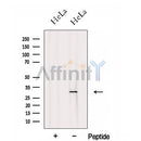 Western blot analysis of extracts from HeLa cells, using FHL2 Antibody. The lane on the left was treated with blocking peptide.