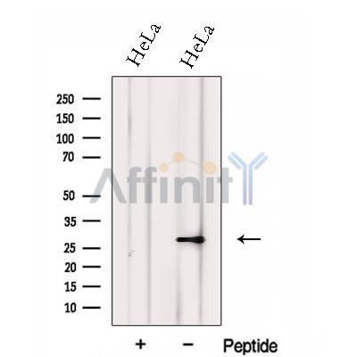 Western blot analysis of extracts from HeLa cells, using FKBP14 Antibody. The lane on the left was treated with blocking peptide.