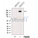 Western blot analysis of extracts from SKOV3 cells, using FMN2 Antibody. The lane on the left was treated with blocking peptide.