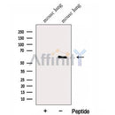 Western blot analysis of extracts from Mouse lung tissue, using FMO5 Antibody. The lane on the left was treated with blocking peptide.