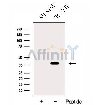 Western blot analysis of extracts from SH-SY5Y cells, using FOXR2 Antibody. The lane on the left was treated with blocking peptide.