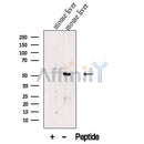 Western blot analysis of extracts from Mouse liver tissue?, using FTCD Antibody. The lane on the left was treated with blocking peptide.