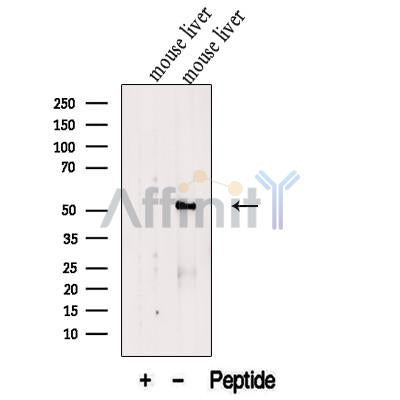 Western blot analysis of extracts from Mouse liver tissue?, using FTCD Antibody. The lane on the left was treated with blocking peptide.