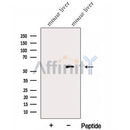 Western blot analysis of extracts from Mouse liver tissue?, using FUCA1 Antibody. The lane on the left was treated with blocking peptide.