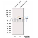 Western blot analysis of extracts from Mouse brain tissue?, using Fukutin Antibody. The lane on the left was treated with blocking peptide.