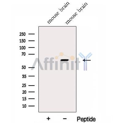 Western blot analysis of extracts from Mouse brain tissue?, using Fukutin Antibody. The lane on the left was treated with blocking peptide.