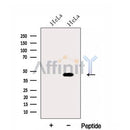 Western blot analysis of extracts from HeLa cells, using FUT6 Antibody. The lane on the left was treated with blocking peptide.