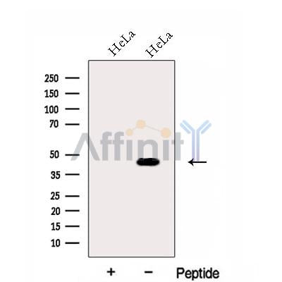 Western blot analysis of extracts from HeLa cells, using FUT6 Antibody. The lane on the left was treated with blocking peptide.