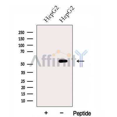 Western blot analysis of extracts from HepG2 cells, using FZR1 Antibody. The lane on the left was treated with blocking peptide.