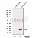 Western blot analysis of extracts from Mouse kidney tissue, using GABARAPL1 Antibody. The lane on the left was treated with blocking peptide.