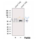 Western blot analysis of extracts from Mouse lung tissue, using GABPB1 Antibody. The lane on the left was treated with blocking peptide.