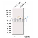 Western blot analysis of extracts from Mouse kidney tissue, using GALNT14 Antibody. The lane on the left was treated with blocking peptide.