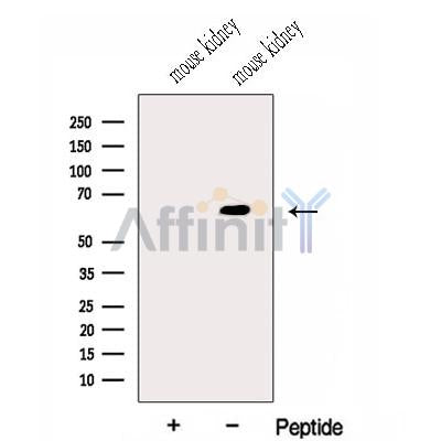 Western blot analysis of extracts from Mouse kidney tissue, using GALNT14 Antibody. The lane on the left was treated with blocking peptide.