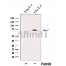 Western blot analysis of extracts from HeLa cells, using GALNT4 Antibody. The lane on the left was treated with blocking peptide.