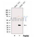 Western blot analysis of extracts from HEK-293 cells, using GAMT Antibody. The lane on the left was treated with blocking peptide.