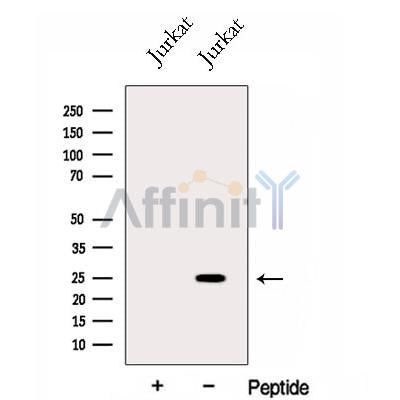 Western blot analysis of extracts from Jurkat cells, using GINS3 Antibody. The lane on the left was treated with blocking peptide.