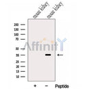 Western blot analysis of extracts from Mouse kidney tissue, using GLOD4 Antibody. The lane on the left was treated with blocking peptide.