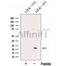 Western blot analysis of extracts from HEK-293 cells, using GM2A Antibody. The lane on the left was treated with blocking peptide.