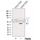 Western blot analysis of extracts from Mouse brain tissue?, using GNAI2 Antibody. The lane on the left was treated with blocking peptide.