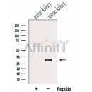 Western blot analysis of extracts from Mouse kidney tissue, using GNPDA2 Antibody. The lane on the left was treated with blocking peptide.