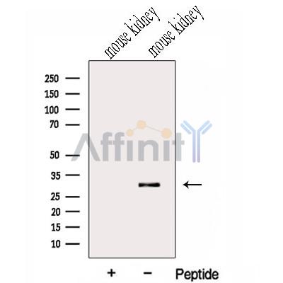 Western blot analysis of extracts from Mouse kidney tissue, using GNPDA2 Antibody. The lane on the left was treated with blocking peptide.