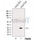 Western blot analysis of extracts from Mouse liver tissue?, using GNPNAT1 Antibody. The lane on the left was treated with blocking peptide.