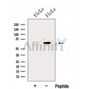 Western blot analysis of extracts from HeLa cells, using GPR177 Antibody. The lane on the left was treated with blocking peptide.