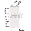 Western blot analysis of extracts from Human kidney tissue, using GTF2H5 Antibody. The lane on the left was treated with blocking peptide.