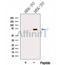 Western blot analysis of extracts from HEK-293 cells, using Harmonin Antibody. The lane on the left was treated with blocking peptide.