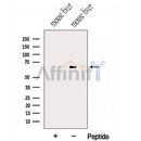 Western blot analysis of extracts from Mouse liver tissue?, using HAS3 Antibody. The lane on the left was treated with blocking peptide.