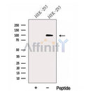 Western blot analysis of extracts from HEK-293 cells, using HEATR2 Antibody. The lane on the left was treated with blocking peptide.