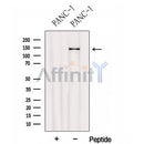 Western blot analysis of extracts from PANC-1 CELLS, using Hephaestin Antibody. The lane on the left was treated with blocking peptide.
