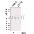 Western blot analysis of extracts from Mouse kidney tissue, using HIST1H1T Antibody. The lane on the left was treated with blocking peptide.