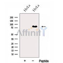 Western blot analysis of extracts from HeLa cells, using HNRNPR Antibody. The lane on the left was treated with blocking peptide.