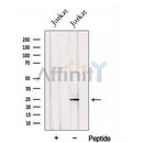 Western blot analysis of extracts from Jurkat cells, using HOP2 Antibody. The lane on the left was treated with blocking peptide.