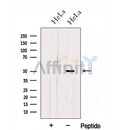 Western blot analysis of extracts from HeLa cells, using HOXA10 Antibody. The lane on the left was treated with blocking peptide.