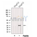 Western blot analysis of extracts from HepG2 cells, using HOXB7 Antibody. The lane on the left was treated with blocking peptide.