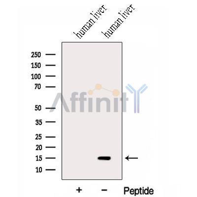 Western blot analysis of extracts from Human liver tissue, using HRSP12 Antibody. The lane on the left was treated with blocking peptide.