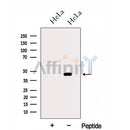 Western blot analysis of extracts from HeLa cells, using HSDL2 Antibody. The lane on the left was treated with blocking peptide.