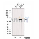 Western blot analysis of extracts from HeLa cells, using HSPA13 Antibody. The lane on the left was treated with blocking peptide.
