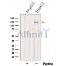 Western blot analysis of extracts from HepG2 cells, using HTATSF1 Antibody. The lane on the left was treated with blocking peptide.