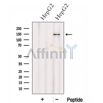 Western blot analysis of extracts from HepG2 cells, using HTATSF1 Antibody. The lane on the left was treated with blocking peptide.