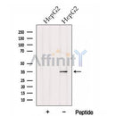 Western blot analysis of extracts from HepG2 cells, using HTRA1 Antibody. The lane on the left was treated with blocking peptide.