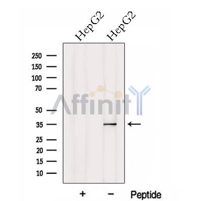Western blot analysis of extracts from HepG2 cells, using HTRA1 Antibody. The lane on the left was treated with blocking peptide.