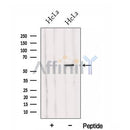 Western blot analysis of extracts from HeLa cells, using HYAL2 Antibody. The lane on the left was treated with blocking peptide.